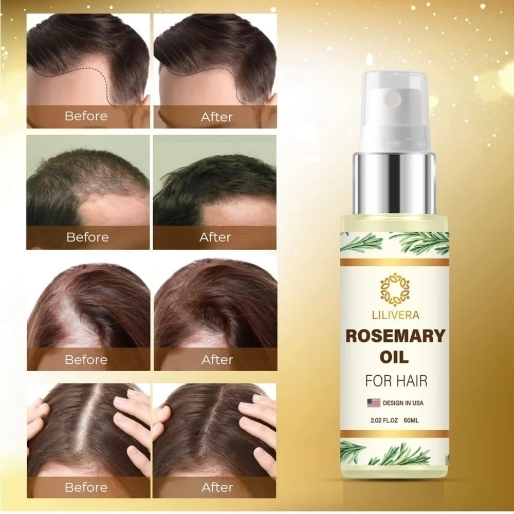 Brand New Rosemary Oil for Hair Growth Nourishes Dry Damaged Hair Treatment